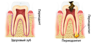 периодонт