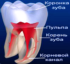 пульпит